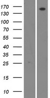 WNK4 Human Over-expression Lysate