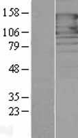 PCDH1 Human Over-expression Lysate