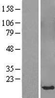 SPANXB1 Human Over-expression Lysate