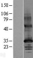 SLC30A2 Human Over-expression Lysate
