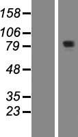 SANBR Human Over-expression Lysate