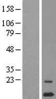 ORF1 FL49 (CYSTM1) Human Over-expression Lysate