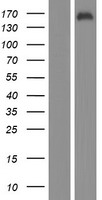 KDM2B Human Over-expression Lysate