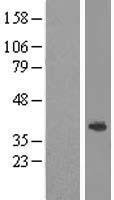 ABHD1 Human Over-expression Lysate