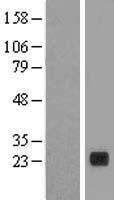 PLA2G12B Human Over-expression Lysate