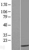 TXNDC17 Human Over-expression Lysate