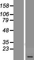 ATP5MK Human Over-expression Lysate