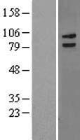 LRCH3 Human Over-expression Lysate