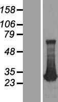 ADO Human Over-expression Lysate
