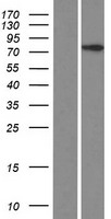 CCDC142 Human Over-expression Lysate