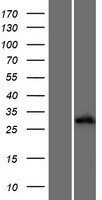 ALKBH6 Human Over-expression Lysate