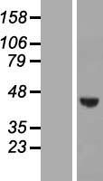 WDR73 Human Over-expression Lysate