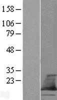 TMEM60 Human Over-expression Lysate