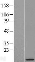 URB1-AS1 Human Over-expression Lysate
