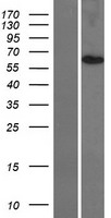TMEM209 Human Over-expression Lysate
