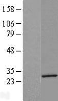 Dystrobrevin alpha (DTNA) Human Over-expression Lysate