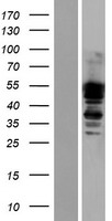 Dystrobrevin alpha (DTNA) Human Over-expression Lysate