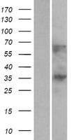 C1orf198 Human Over-expression Lysate