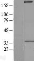 NALP1 (NLRP1) Human Over-expression Lysate