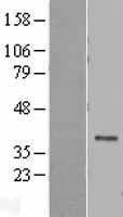 DEDD Human Over-expression Lysate