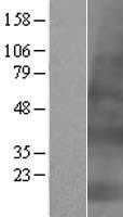 KRTAP4-2 Human Over-expression Lysate