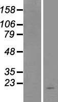 TSLP Human Over-expression Lysate