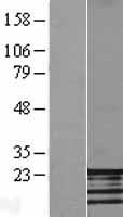 FATE1 Human Over-expression Lysate
