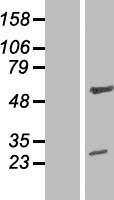 ZNF101 Human Over-expression Lysate