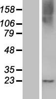 RASL10B Human Over-expression Lysate