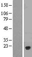 Caveolin 3 (CAV3) Human Over-expression Lysate