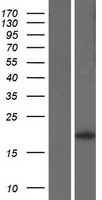 KRAS Human Over-expression Lysate