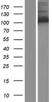 Hexokinase 1 (HK1) Human Over-expression Lysate