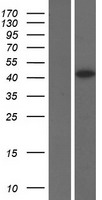 TSPYL5 Human Over-expression Lysate