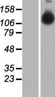 HELB Human Over-expression Lysate