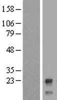 CTBP1-DT Human Over-expression Lysate