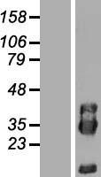 PIK3IP1 Human Over-expression Lysate