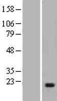 Myosin light chain kinase (MYLK) Human Over-expression Lysate