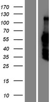 DACH2 Human Over-expression Lysate