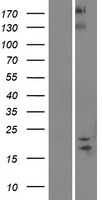 SPAG11B Human Over-expression Lysate