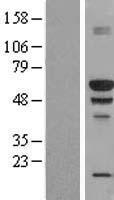BANP Human Over-expression Lysate