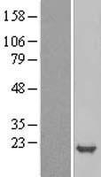 p19 INK4d (CDKN2D) Human Over-expression Lysate