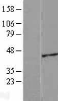 ACTRT2 Human Over-expression Lysate