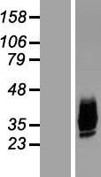Aquaporin 10 (AQP10) Human Over-expression Lysate
