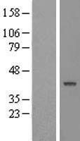 TCPTP (PTPN2) Human Over-expression Lysate