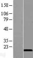CST9L Human Over-expression Lysate