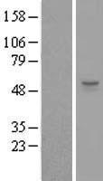 ZSWIM1 Human Over-expression Lysate