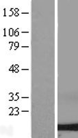 Dynein (DYNLL2) Human Over-expression Lysate