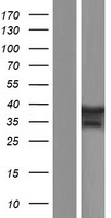 TBX6 Human Over-expression Lysate