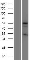 KRT72 Human Over-expression Lysate