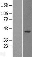 WDR89 Human Over-expression Lysate